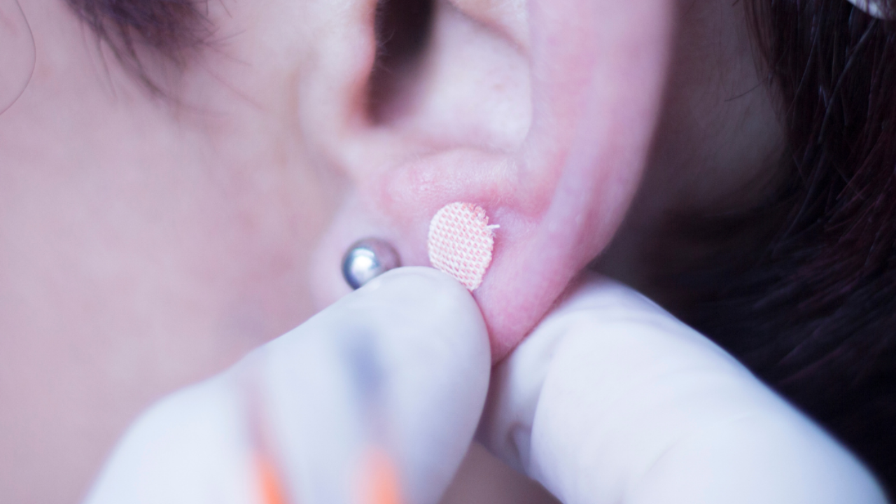Benefits of EarSeeds by Michael Allison